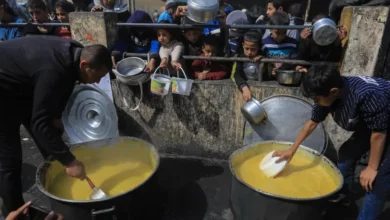 صورة الجوع.. مرآة تكشف هشاشة الحضارة وسقوطها الأخلاقي