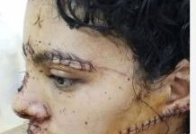صورة نداء حقوقي عاجل: مساندة الشابة إيمان في مواجهة الجريمة والعنف