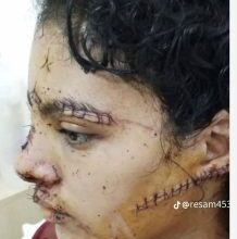 صورة نداء حقوقي عاجل: مساندة الشابة إيمان في مواجهة الجريمة والعنف
