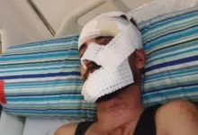 صورة الحسبمة : حادثة مأساوية ببني بوعياش تفضح هشاشة البنية التحتية وعجز المركز الاستشفائي بأجدير