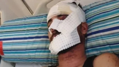صورة الحسبمة : حادثة مأساوية ببني بوعياش تفضح هشاشة البنية التحتية وعجز المركز الاستشفائي بأجدير
