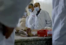 صورة الطب الشرعي في المغرب يواجه أزمة موارد تُربك العدالة