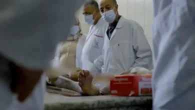 صورة الطب الشرعي في المغرب يواجه أزمة موارد تُربك العدالة
